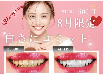 エクシアホワイトニング 稲沢店の写真