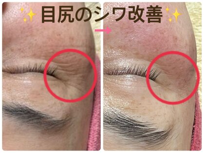 トルル(Tlulu)の写真
