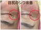 トルル(Tlulu)の写真
