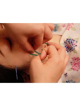 眼精疲労を解消したい