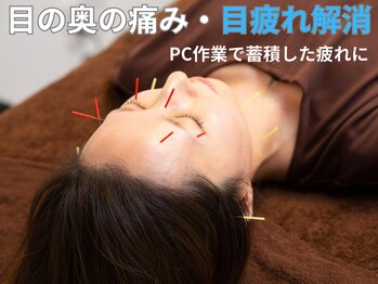 サロンスマイル/目疲れ解消!パッチリ目元美容鍼