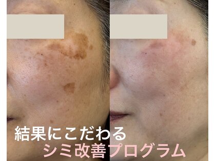 ユーブルーム(youbloom)の写真