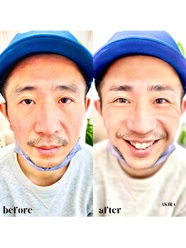 まつげエクステ専門店 アンリール(Anrire)/メンズ眉毛/アイブロウ/自由が丘