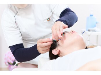 チアー鍼灸接骨院 整体院(CHEER鍼灸接骨院 整体院)/美容鍼