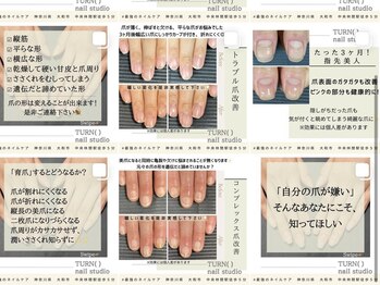 ターンネイルスタジオ 中央林間(TURN nail studio)/最強のネイルケア導入店◎