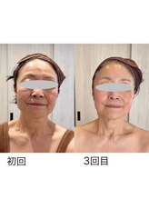 リアン(Liam)/小顔矯正頭蓋調整＆美肌ケア