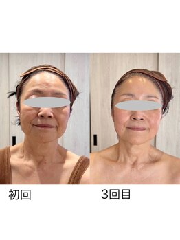 リアン(Liam)/小顔矯正頭蓋調整&美肌ケア