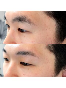 アンドスリー 原宿 表参道店(And Three)/三角眉毛の解消　平行眉毛へ