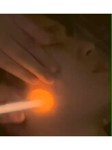 小顔ウナ学芸大学店(UNA)/プラズマ美容マシン