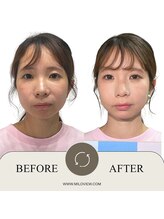 ミラビュー(MILOVIEW)/あなたが1番輝くStyleをご提案