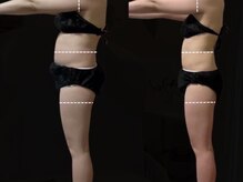 ヨサパーク ベル(YOSA PARK Belle)/綺麗に細くなる！