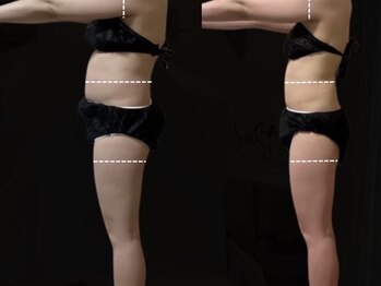 ヨサパーク ベル(YOSA PARK Belle)/綺麗に細くなる！