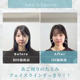 キューサッポロ(SalonQSapporo)