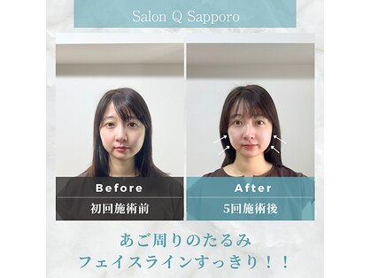 キューサッポロ(SalonQSapporo)の写真