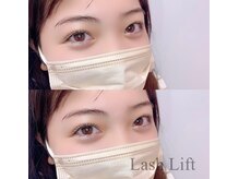 ベラルーナ 那覇おもろまち店(Bella Luna)/ラッシュリフト