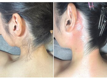 エヴァワックス 大阪 南堀江店(Eva Wax)/脱毛/ブラジリアンワックス