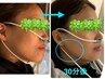 変化最速で人気急上昇！水素スピード痩せコース90分（LULUONN+水素吸入）