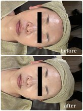 ジャスミン(Jasmin)/モイスチャーフェイシャル