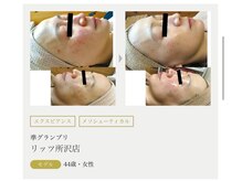 まりも化粧品店/ホワイトスノーピール