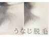うなじキレイ脱毛 ¥3,300