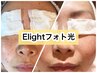 【超オススメ！】肌荒れを改善！★E-LIGHT フォト光★【ご新規様は6,000円】