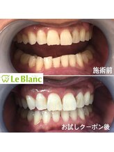 ルブラン 奈良店(Le Blanc)/15分2回照射！
