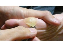 四季縁/足裏の角質、気になりませんか？