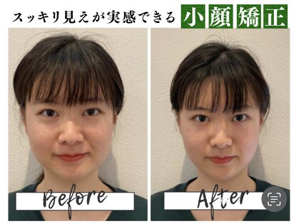 リモド(Rimodo509)の写真
