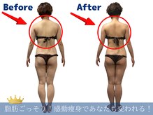ワクワクボディクリニック 中央林間店(WAKUWAKU BODY CLINIC)の雰囲気（ハイパーナイフで痩身ダイエット＆たるみ改善！ブライダルも◎）