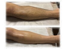 メンズブリリアンス/★両ひざ下ＷＡＸ★