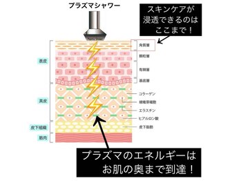 ハウピア(Haupia)/プラズマ全ての悩みにアプローチ
