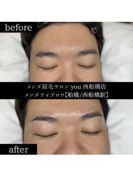 ユー 西船橋店(you)/ビフォーアフター写真