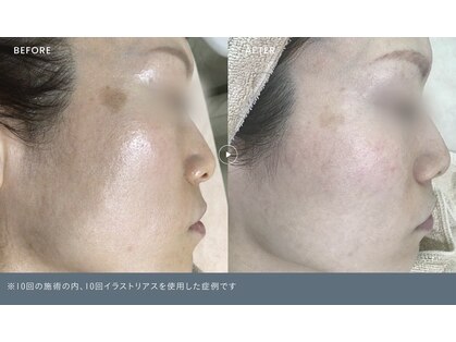プアプア(Pua Pua)の写真
