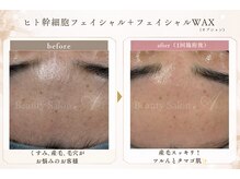 エース(A)の雰囲気(気になる【産毛・くすみに】フェイシャルWAXでたまご肌☆)