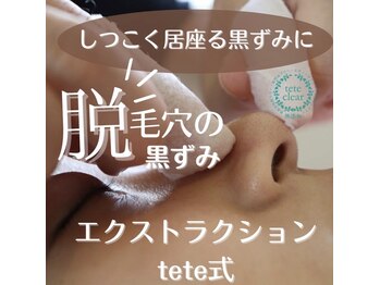 アイシェリー(eyecherie)/毛穴エクストラクション