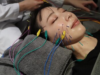 ビーロイヤル(B-ROYAL)/電気を流し肌の深層部まで