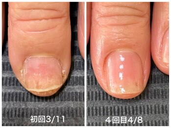 自爪育成4回目の成果♪