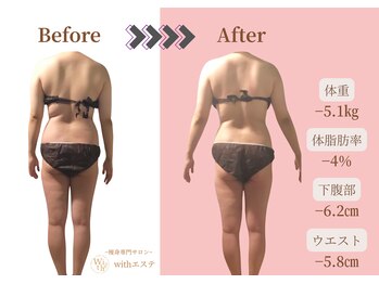 ウィズエステ(withエステ)/