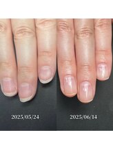 ココ(COCO)/ハンドケア・自爪育成・深爪育成