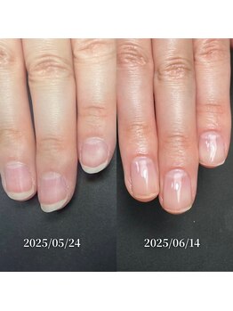 ココ(COCO)/ハンドケア・自爪育成・深爪育成