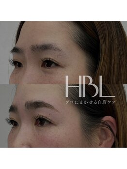 ロジ(loji)/ハリウッドブロウリフト