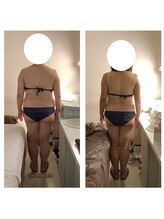 アクア エステティコ 亀有(ACQUA estetico)/痩身　90分上半身