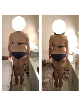 アクア エステティコ 亀有(ACQUA estetico)/痩身　90分上半身