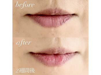 パールピーチ(total beauty place pearl peach)/メラニンケア☆