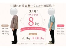 ウェルネ 田原院の雰囲気（50代のビフォーアフター）