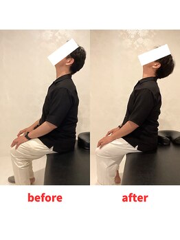 ナオル整体 福岡香椎院(NAORU整体)/40代男性施術事例【首の痛み】