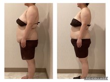 ボーテ(beaute)/【ビフォーアフター】