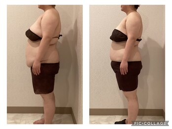 ボーテ(beaute)/【ビフォーアフター】