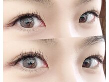 フィーネ ヴァレンテ アルプス通り店/＊施術イメージ＊