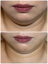 フィフ(fif)/レモンボトルで二重あご撃退！